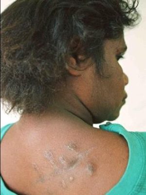 An Aboriginal woman who was attacked with a knife by her partner